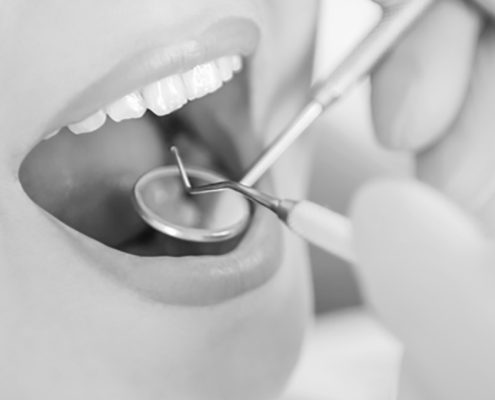 Curetaje dental