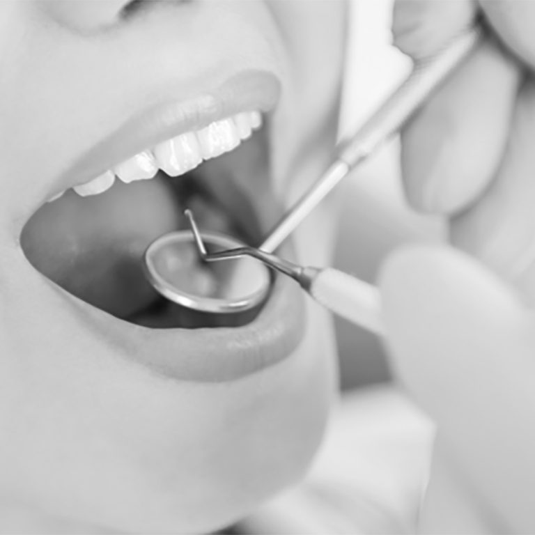 Curetaje dental