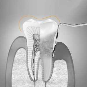 periodoncia, qué es
