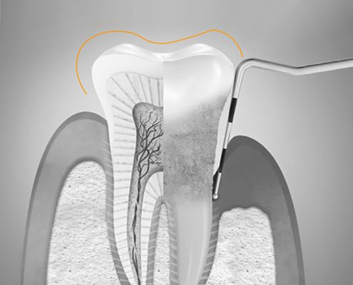 periodoncia, qué es