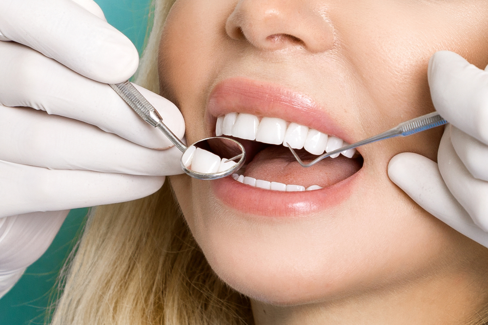 persona a la cual se le están colocando unas carillas dentales