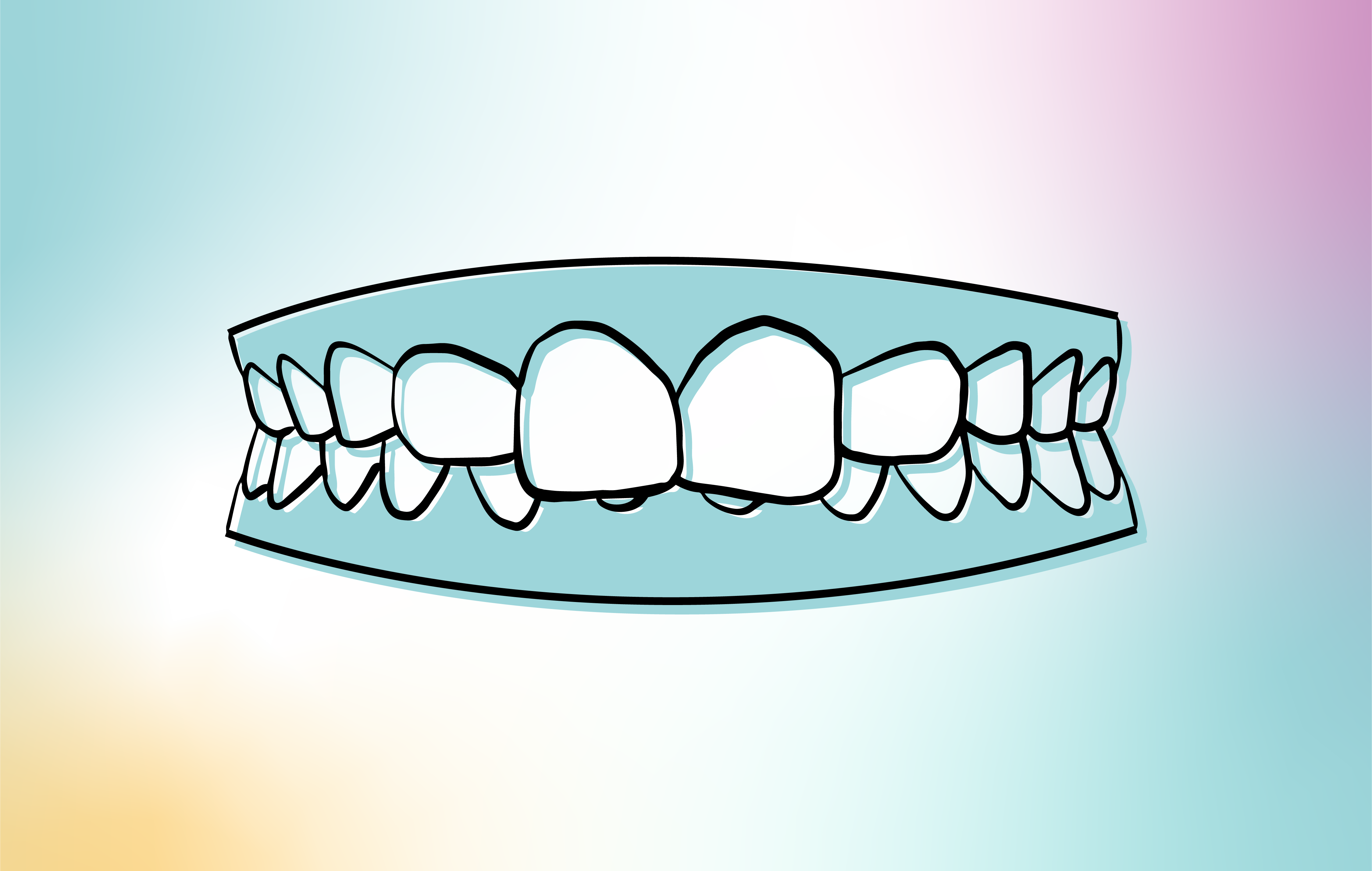 y 5. Boca cerrada y boca abierta, apiñamiento dental. Mordida cruzada.