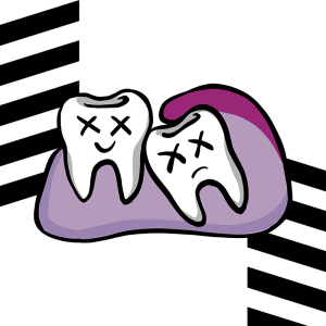 Qué es la pericoronitis