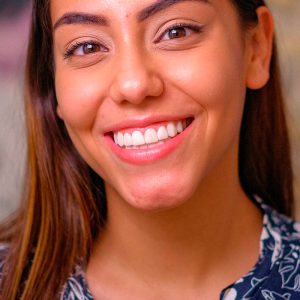 ¿Cómo cuidar las carillas dentales para que duren más tiempo?