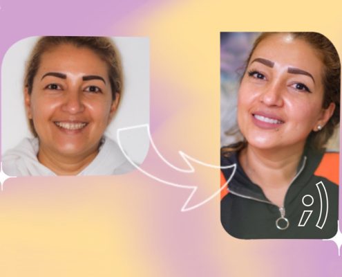 diseño de sonrisa