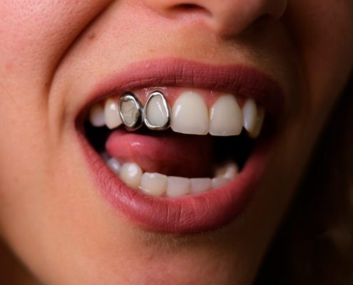 Grillz para tus dientes