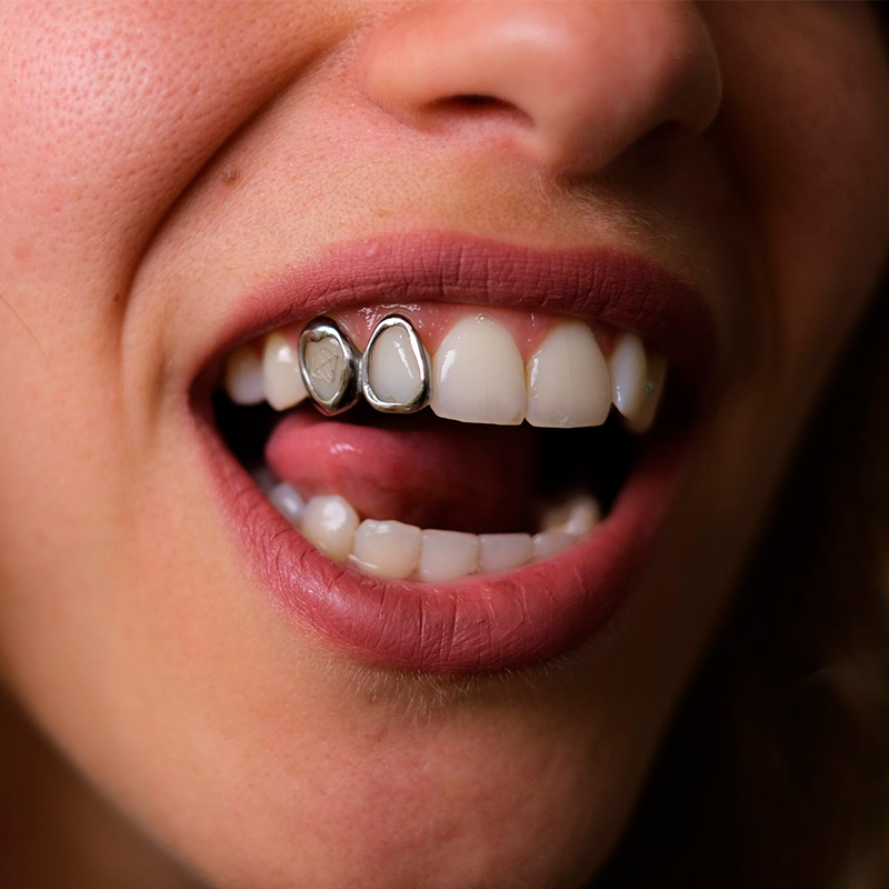 Grillz para tus dientes