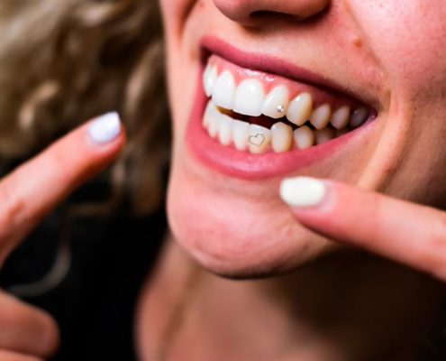 Stickerz gema dental
