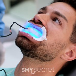 Causas y soluciones para los dientes amarillos