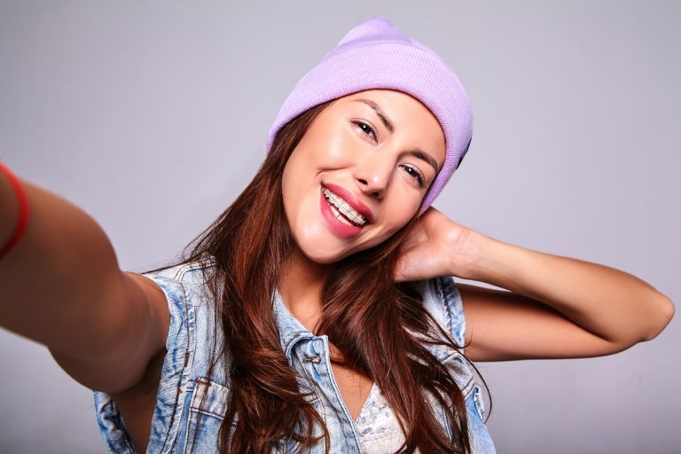 Tipos de brackets transparentes