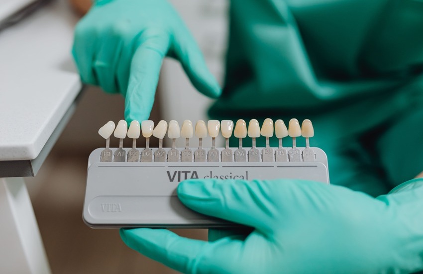 Carillas de porcelana ventajas y desventajas Smysecret