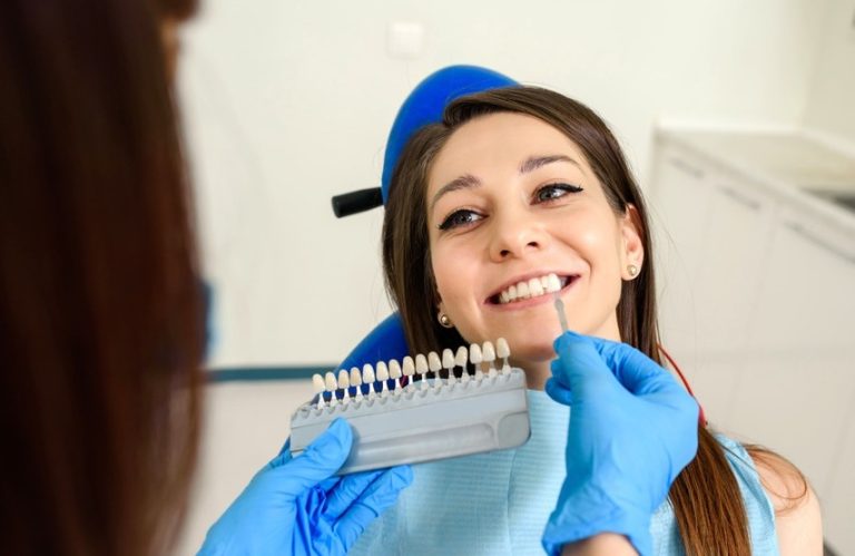Cómo cuidar las carillas dentales para que duren más tiempo