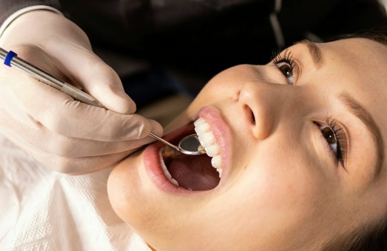 ¿Cuánto dura el efecto de un blanqueamiento dental?