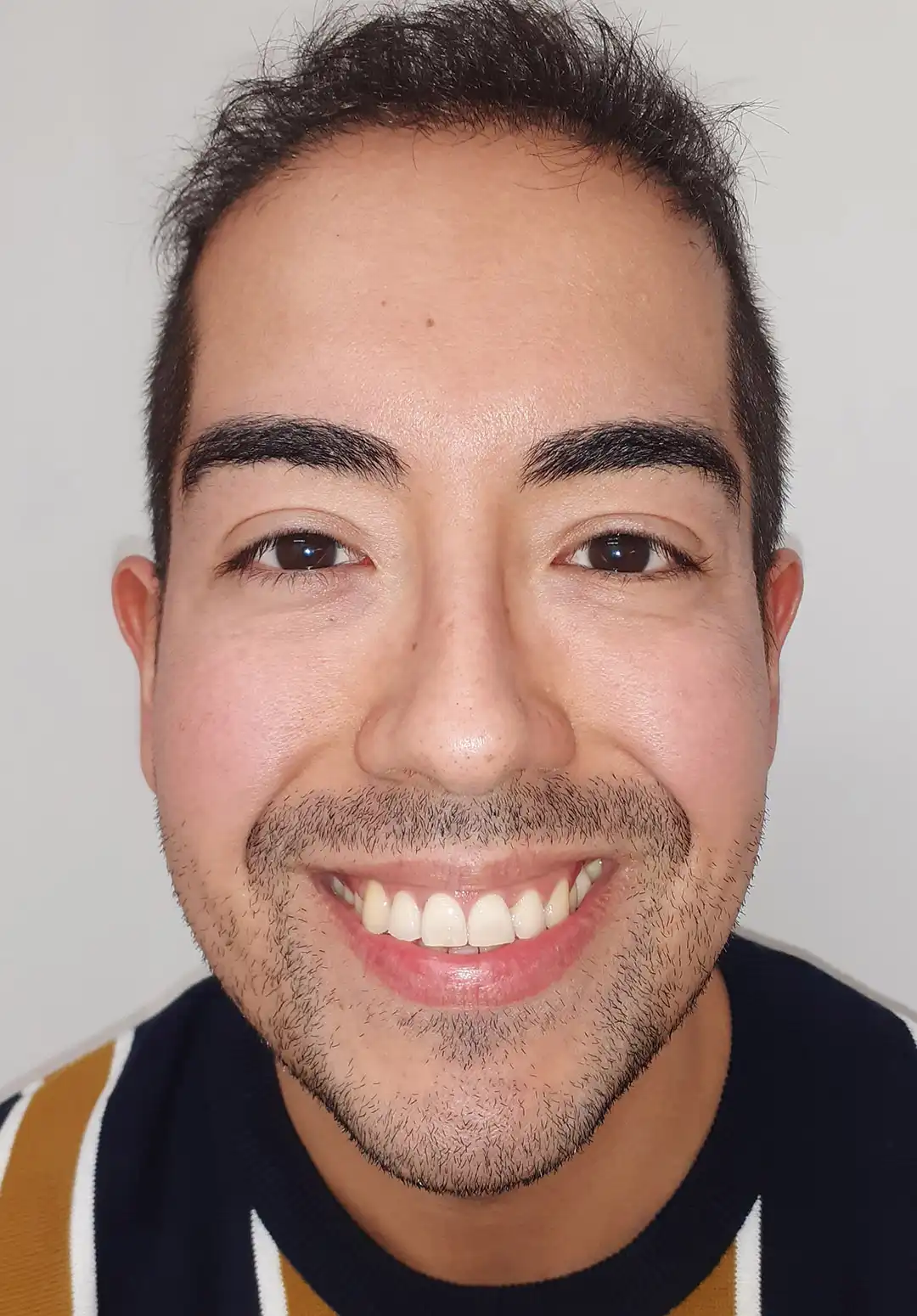 Carlos Baeza, antes