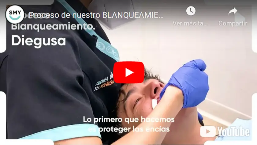 Vídeo
