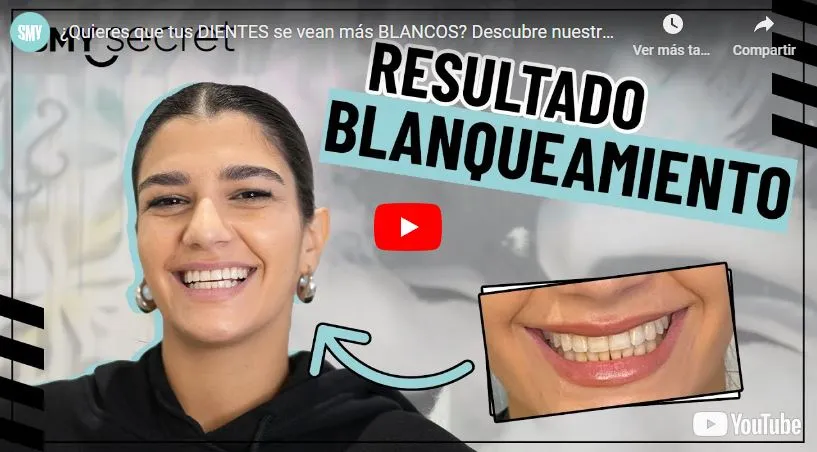 Vídeo
