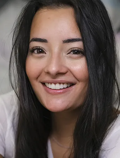 Chica sonriente después de recibir un tratamiento de blanqueamiento dental en Smysecret.