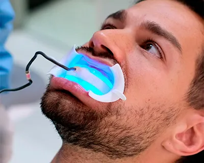 Dientes amarillos. Causa y soluciones.