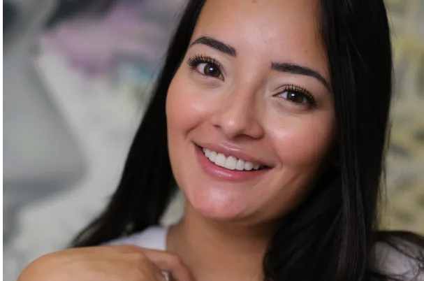 Chica sonriente tras recibir tratamiento de carillas de composite en Smysecret.