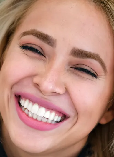 Chica sonriente tras recibir tratamiento de carillas dentales en Smysecret.