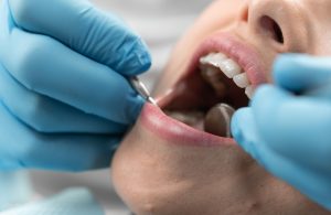Odontólogo realizando una exploración para diagnosticar una maloclusión dental