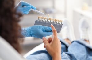 Tipos de blanqueamiento dental y sus precios
